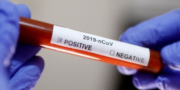 koronavirus-nedir-covid-19-belirtileri-neler-turkiyede-vaka-var-mi-DvjeFmI8.jpg