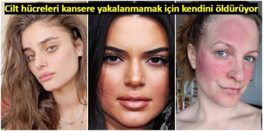cildiniz-size-bir-seyler-anlatmaya-calisiyor-sikca-gorulen-cilt-sorunlari-aslinda-ne-manaya-geliyor-PZneN1qX.jpg