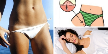 onlara-yokmus-uzere-davranamayiz-bikini-bolgesi-sivilceleri-hakkinda-bilmeniz-gereken-her-sey-w1SmcGiR.jpg