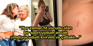 tum-gercekligi-ile-dogum-sonrasi-bedenlerini-paylasan-14-annenin-guc-ve-guzellikle-dolu-fotograflari-EUP765e5.jpg